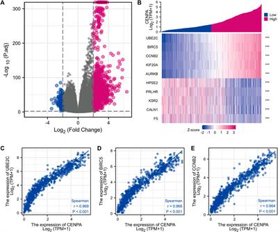 CENP-A is a potential prognostic biomarker and correlated with immune infiltration levels in glioma patients